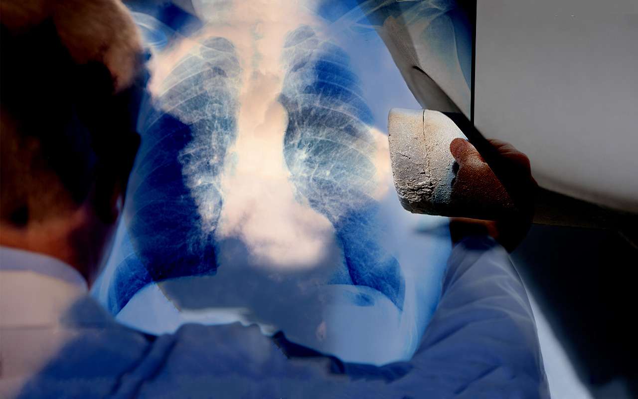 Пора избавляться от бензиновых двигателей - названа главная причина