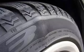 Грыжа легко определяется осмотром.