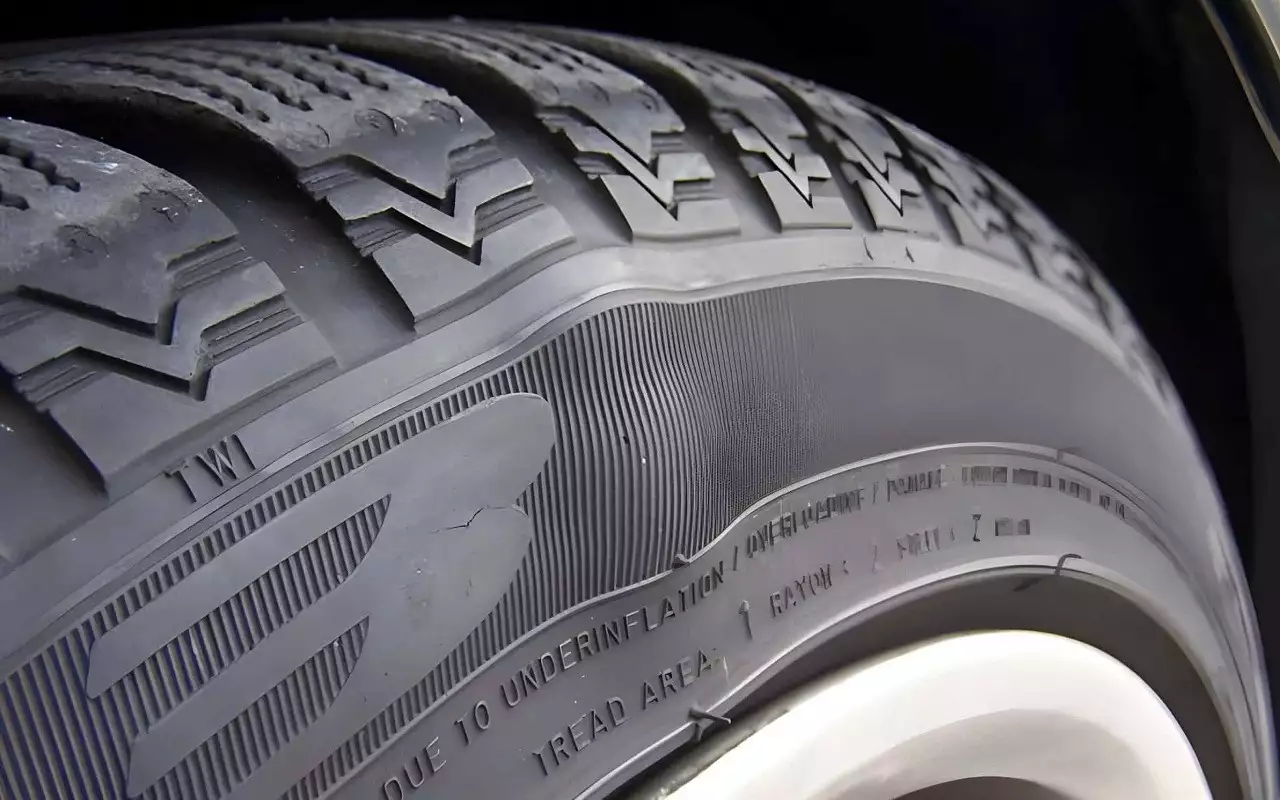 Грыжа легко определяется осмотром.