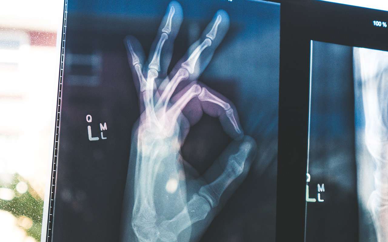 В этих странах ваши шансы получить травму самые высокие