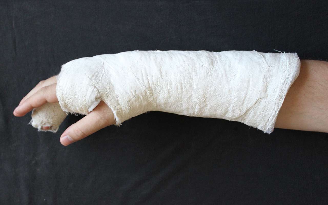 Сосед водит со сломанной рукой – вот что он говорит инспекторам ГИБДД