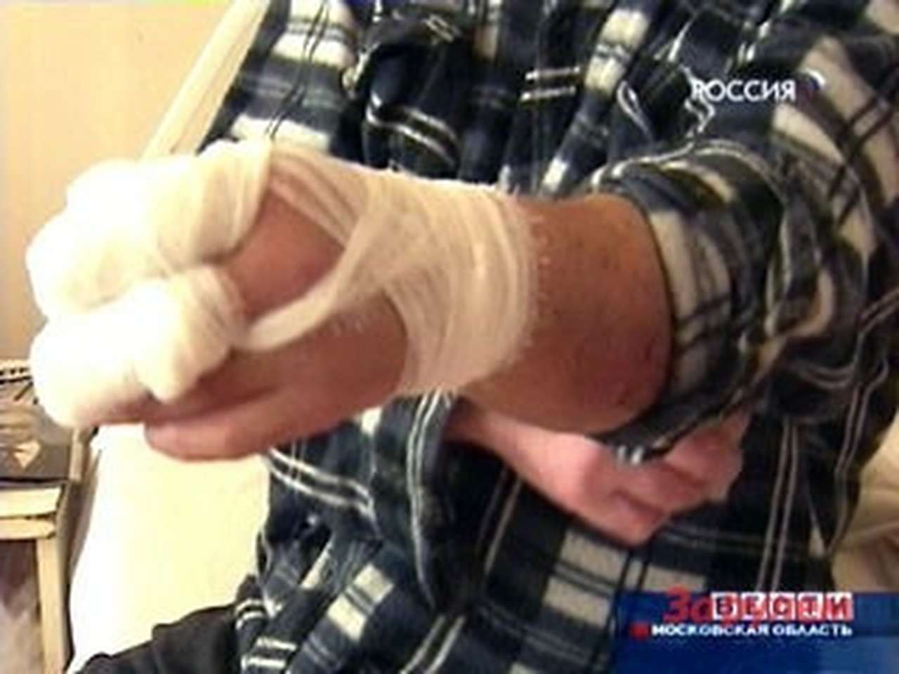 В Москве покусали инспектора ГИБДД