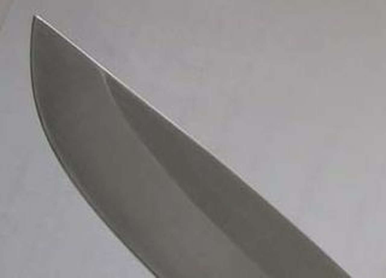 В Москве таксист-частник отрезал ухо пассажиру