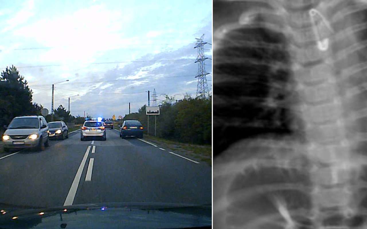 Ребенок проглотил булавку. В больницу пришлось ехать с полицейскими мигалками!